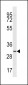 TMIGD2 Antibody (Center)